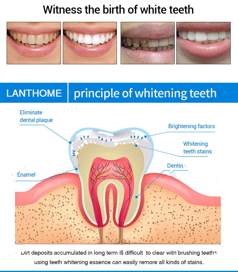 Lanthome™ Teeth Whitening Pen